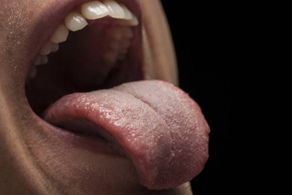 چرا زبان می سوزد؟